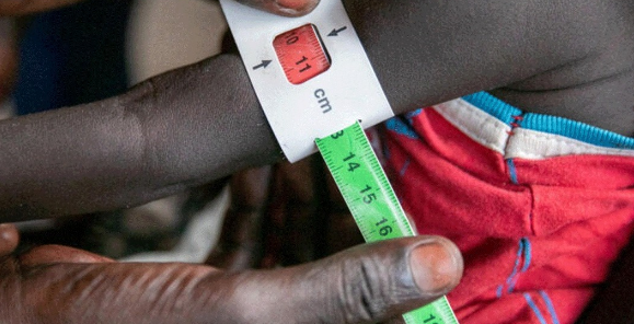 Watoto Kupewa Vileo Sababu ya Ongezeko la Udumavu Iringa